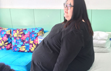 新华网陕西频道图片 :  中国首胖488斤 切胃减肥